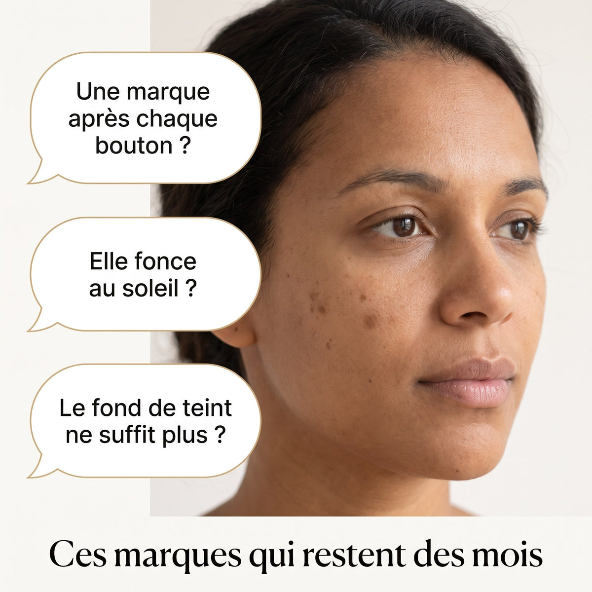 Marques brunes laissées par les boutons sur une peau mate